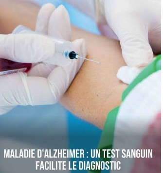 Alzheimer : la prise de sang pourrait-elle r&eacute;volutionner le diagnostic ?