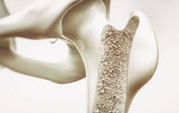 Prévenir l'ostéoporose