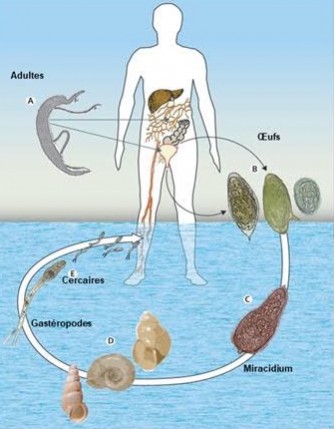 La schistosomiase