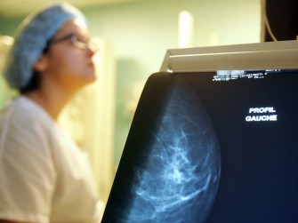 Plan national anti-cancer: définition des zones pilotes pour le dépistage du cancer du sein