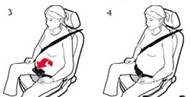 Il vaut toujours mieux porter une ceinture de sécurité, et les femmes enceintes, devraient s’assurer de la mettre correctement.
