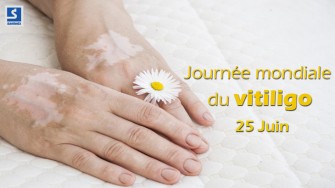 25 Juin : Journée mondiale du vitiligo