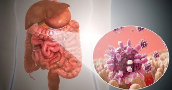 Gastro-ent&eacute;rites en &eacute;t&eacute; : quand les plaisirs de la plage peuvent tourner au malaise