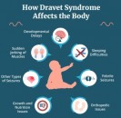 Le Syndrome de Dravet