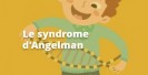 Syndrome dangelman